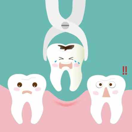 拔牙會痛嗎？什麼情況要拔牙？牙齒一直搖會掉嗎？完整解析拔牙過程 post thumbnail image