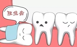 阻生齒预防 阻生齒预防