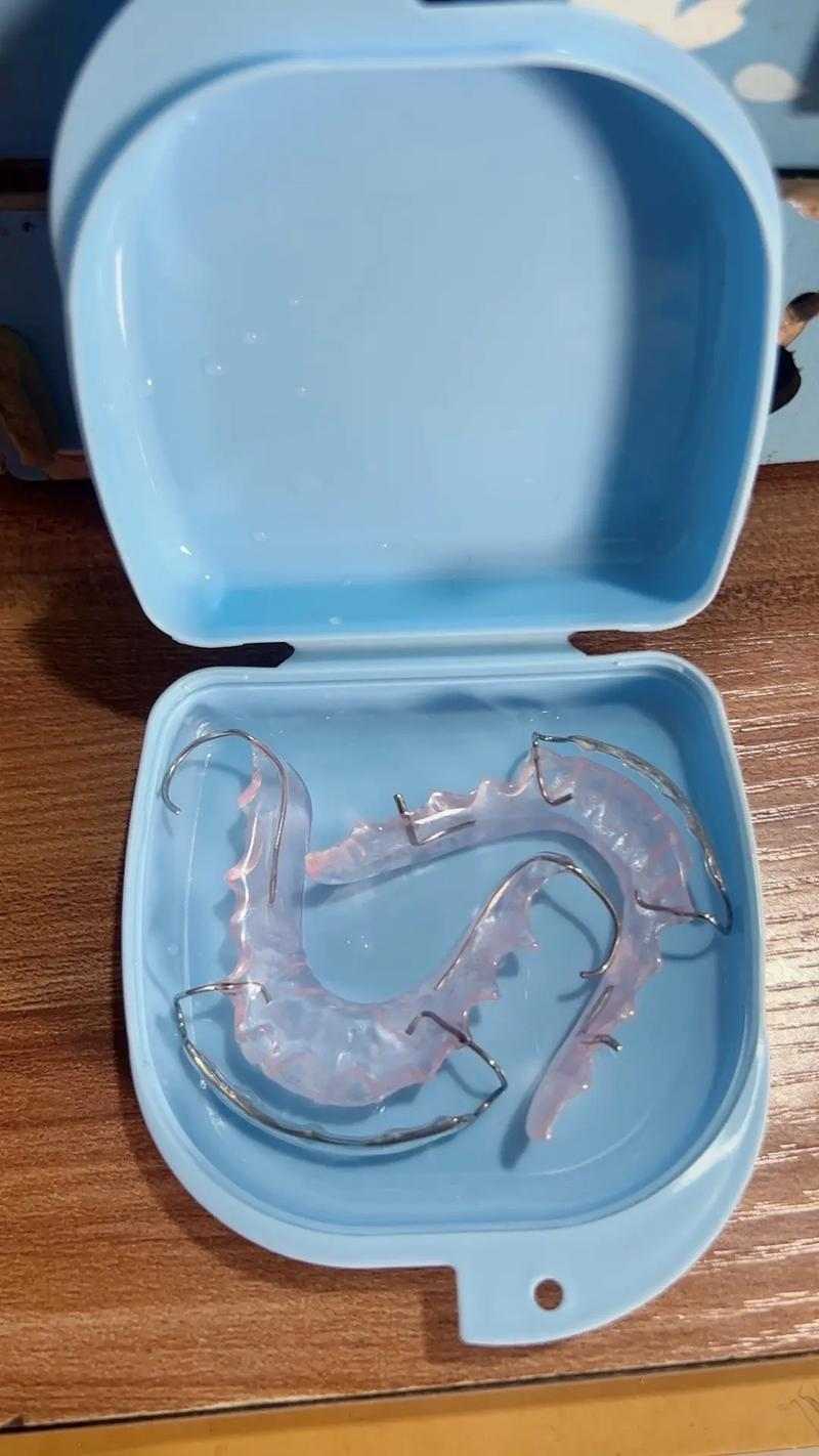 牙套種類